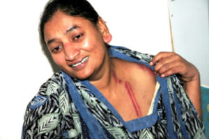 شکنجه زنی کارگر در بحرین که توسط سفارت هند در بحرین رسانه ای شد